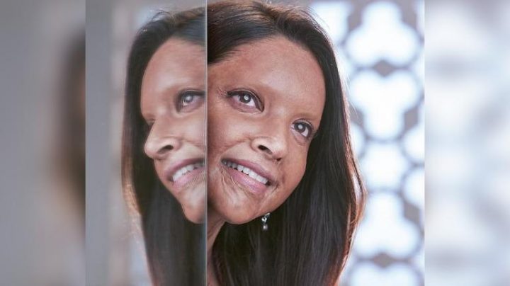 Chhapaak First Look: Deepika Padukone’s Look as Acid Attack Survivor Revealed; See Pic